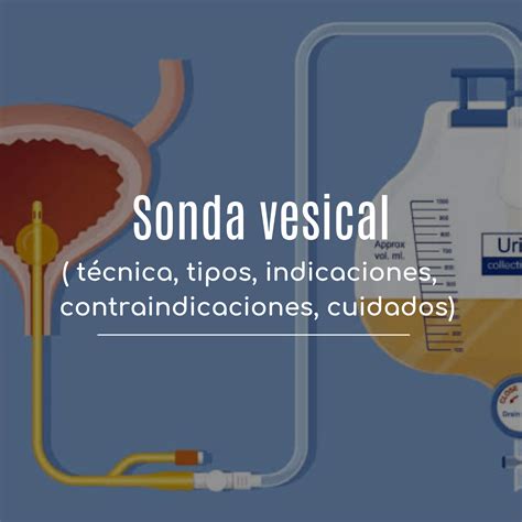 sonda vesical mujer real|Sonda Vesical técnica de colocación